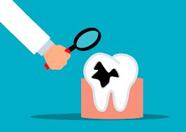 Dental caries 