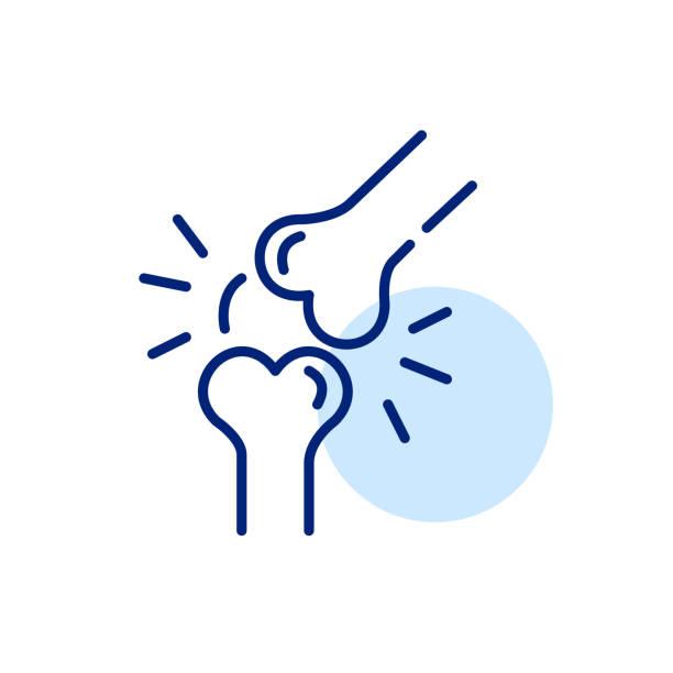 Knee Pain