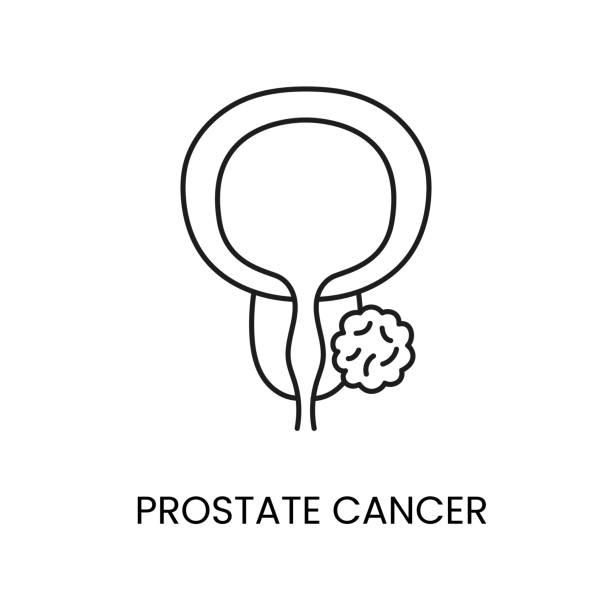 Prostate Cancer
