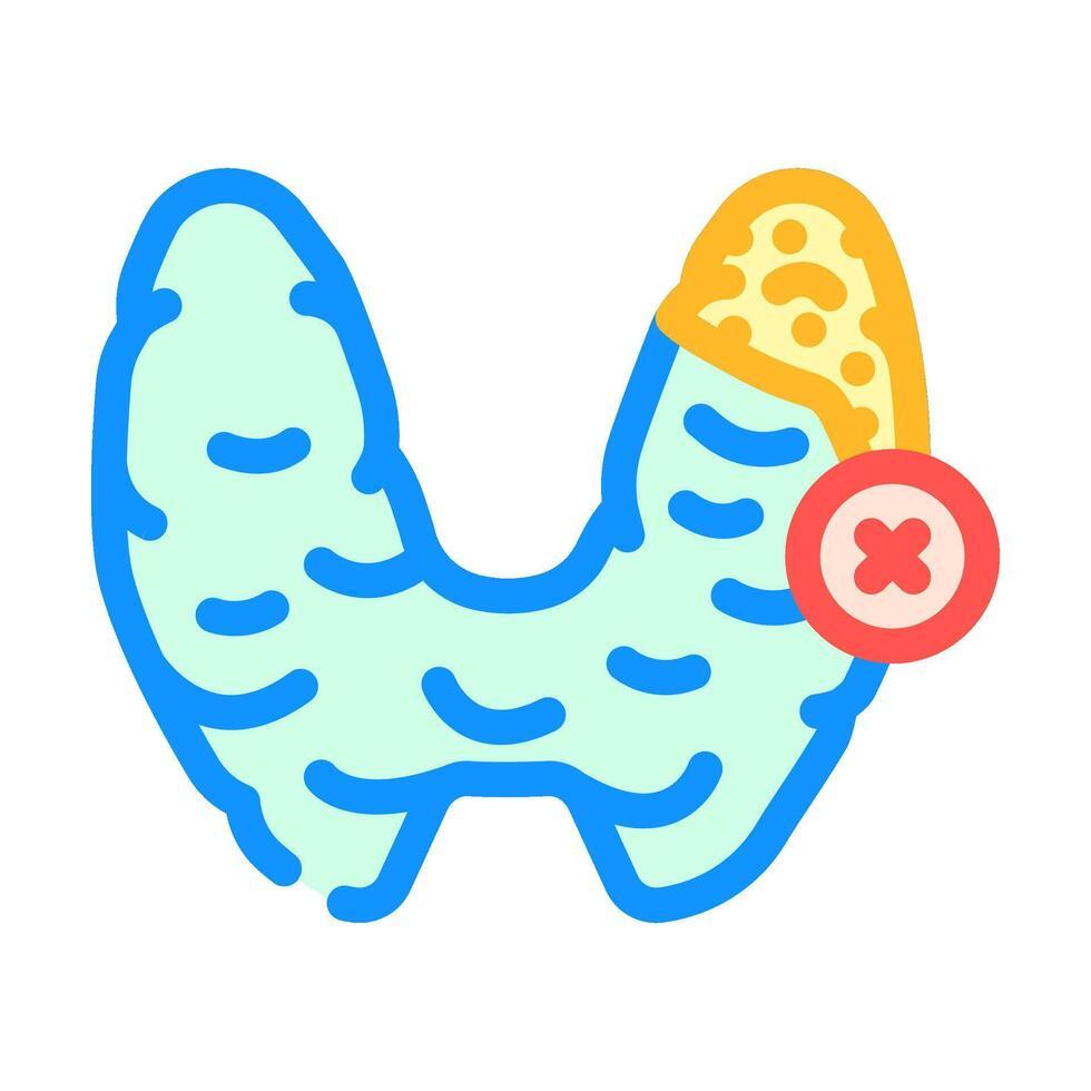 Thyroid Surgery